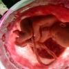 Large fetus: features of pregnancy and childbirth?